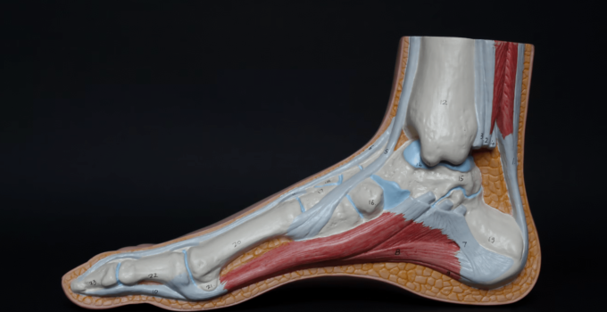 Achilles Tendon Injury explanation and understanding