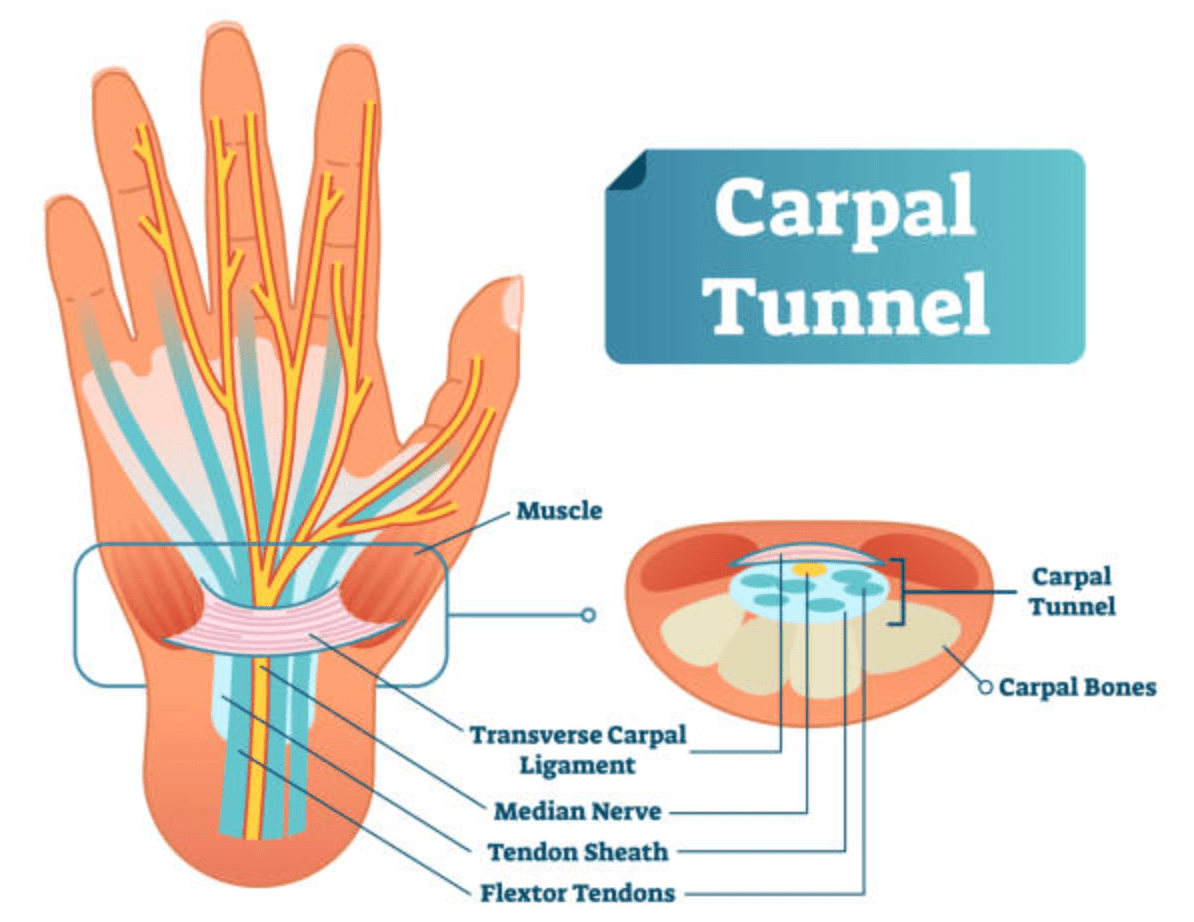 Carpal Tunnel Syndrome anatomy