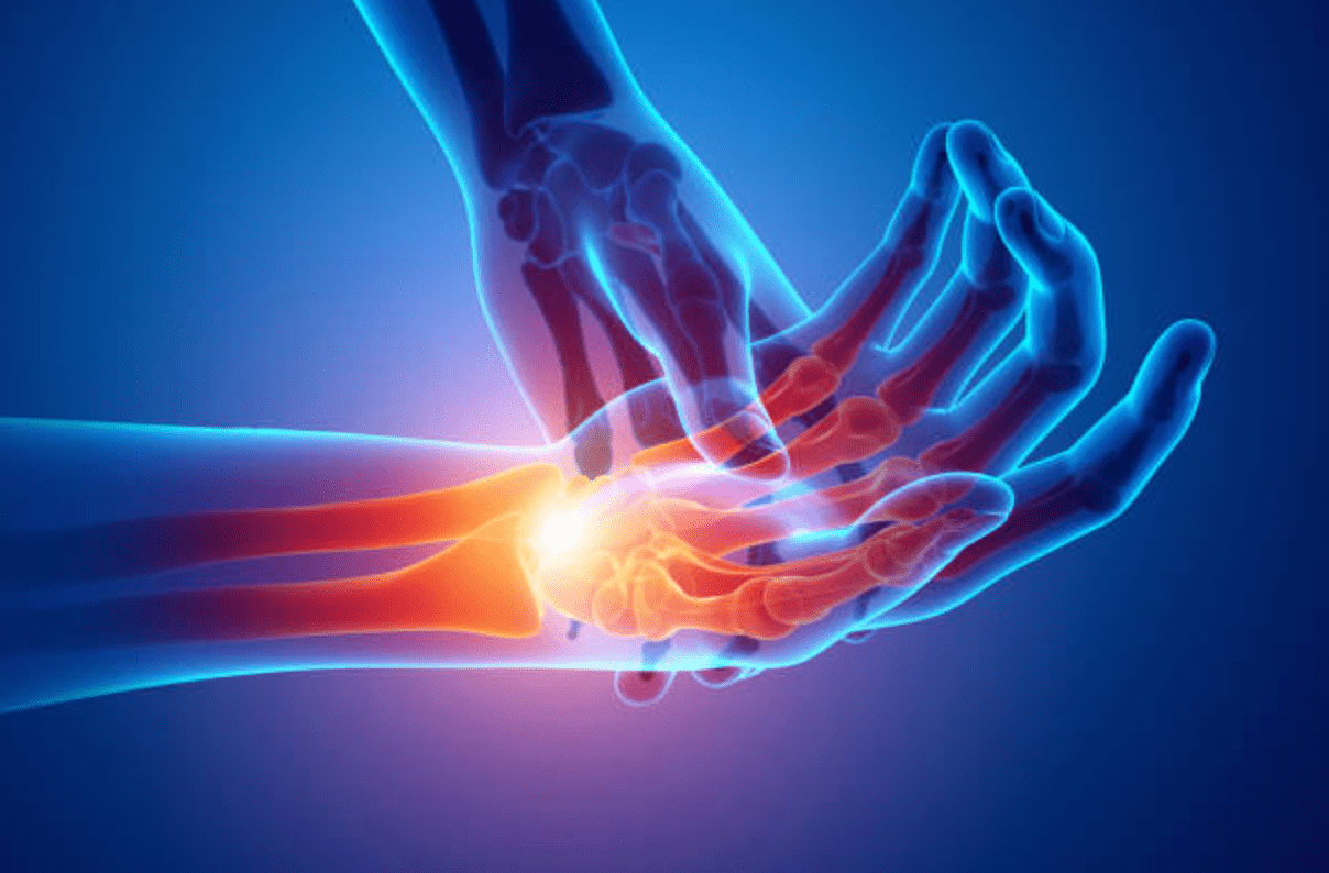Inflammatory pain in wrist