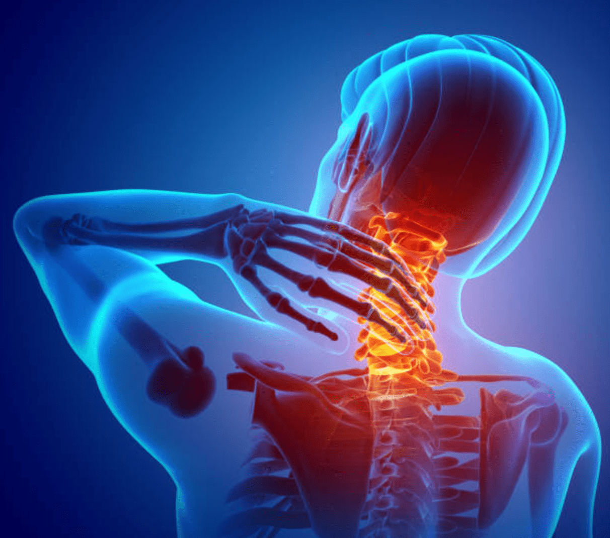 Neck injury leading to cervical concerns