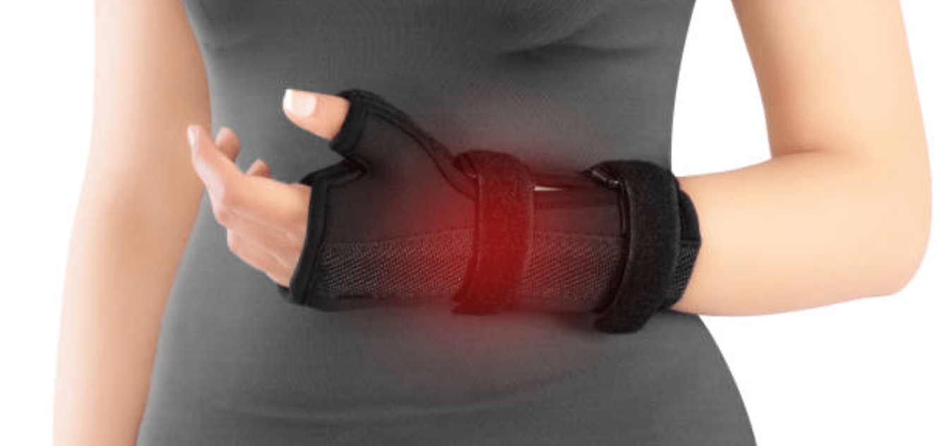 Understanding Carpal Tunnel Syndrome