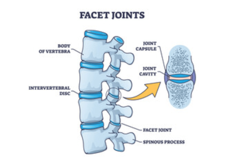 Understanding Facet Joint Syndrome