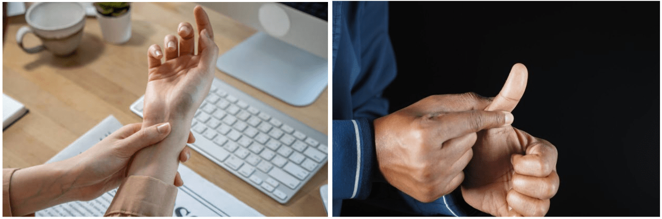 What are the two conditions that are often misdiagnosed as carpal tunnel syndrome