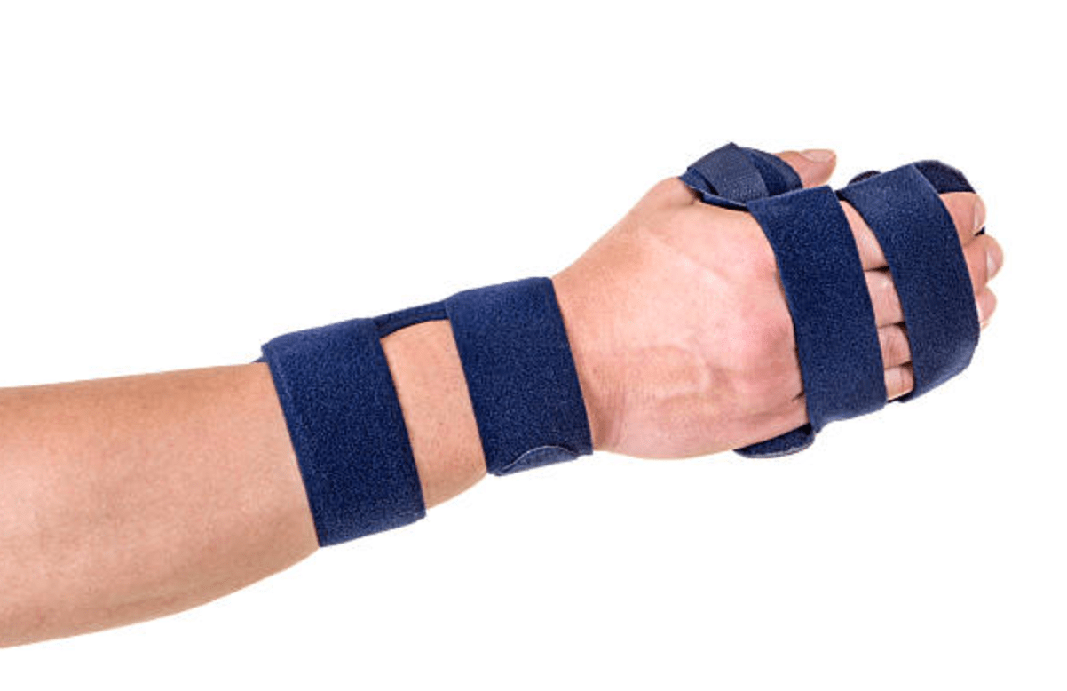 Wrist Braces with Supporting Structure for the Fingers
