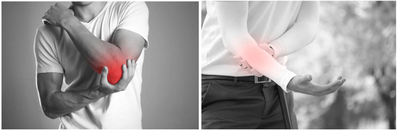 difference between tennis elbow and golf elbow